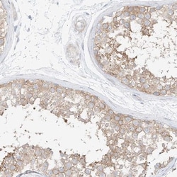 SAPS2 Antibody, Novus Biologicals 25 &mu;L; Unlabeled:Antibodies, Polyclonal